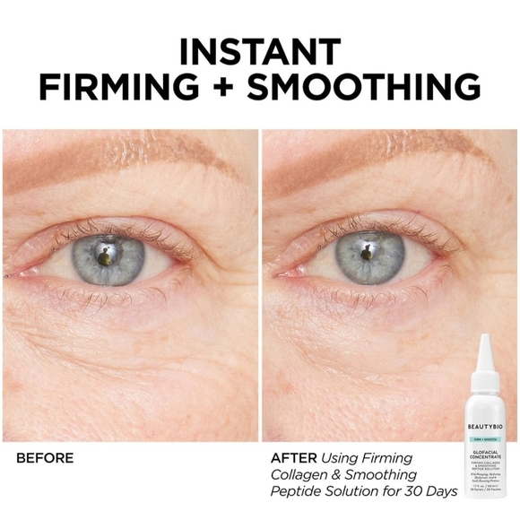 Beautybio Pro Hydration Facial Pore Detox & Skincare Set - Picture 9 of 10